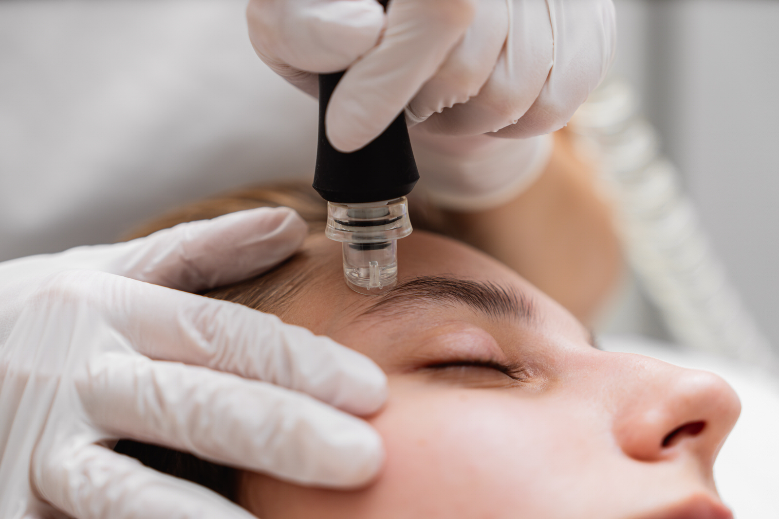 Tratamiento Facial Ácido Hialurónico en Alcorcón