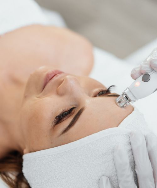 Hidrodermoabrasión en Alcorcón