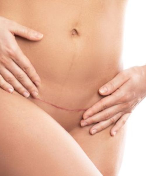 Masajes postoperatorios