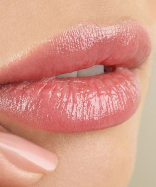 Descubre los beneficios del ácido hialurónico para labios en el Centro de Estética Viviana Luna en Alcorcón