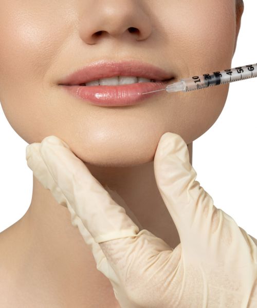 Mujer recibe ácido hialurónico con la técnica de relleno de labios para Russian Lips
