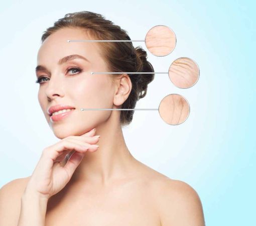Microneedling facial: qué es, para qué sirve y qué resultados esperar
