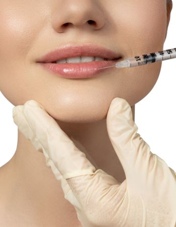 Mujer recibe ácido hialurónico con la técnica de relleno de labios para Russian Lips